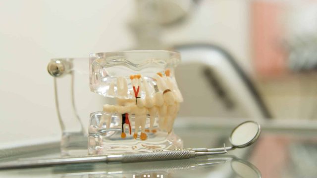 Енді екінің бірі стоматология аша алмайды