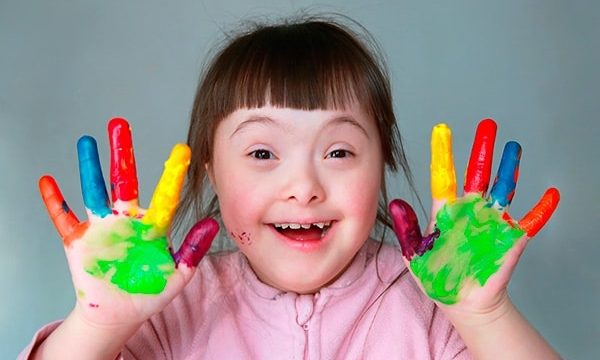 Даун синдромын қалай анықтауға болады?