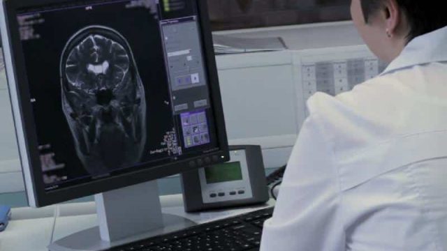 Қазақстанда ми ісігін отасыз емдеу қолға алынады