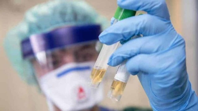 Өзбекстанда коронавирустың «ұлыбританиялық штамы» анықталды