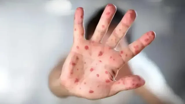 Қазақстан қызылшаның таралуы бойынша әлемде бірінші орынға шықты